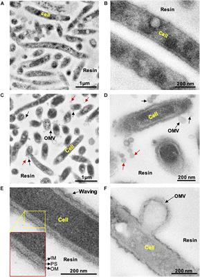 Biogenesis of Outer Membrane Vesicles Concentrates the Unsaturated Fatty Acid of Phosphatidylinositol in Capnocytophaga ochracea